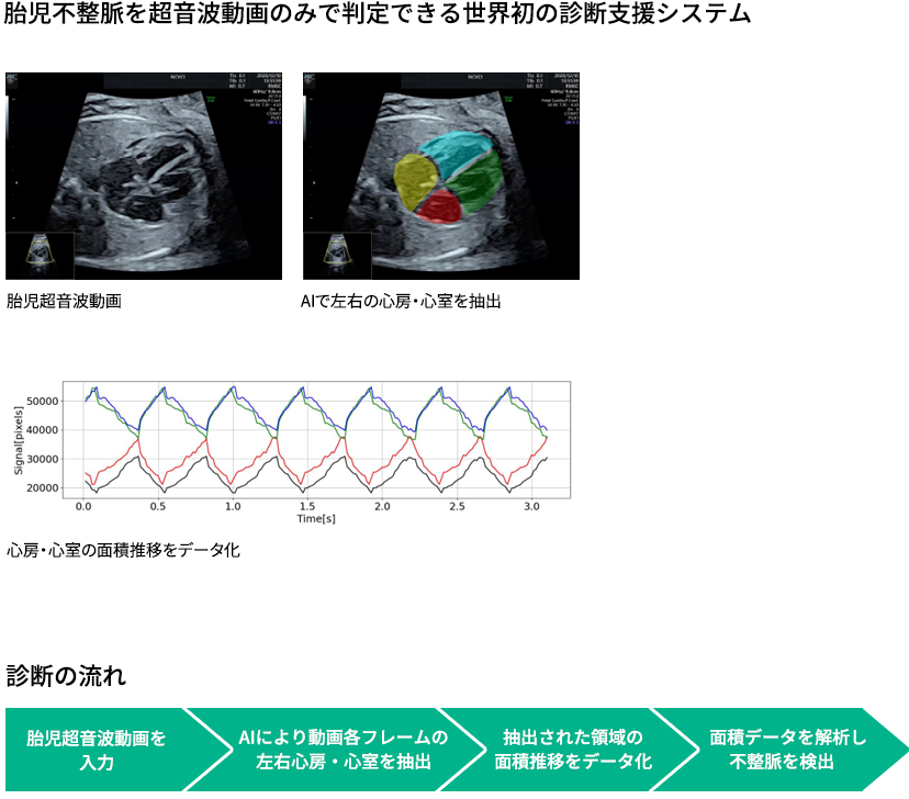超音波診断動画による胎児不整脈診断支援システム