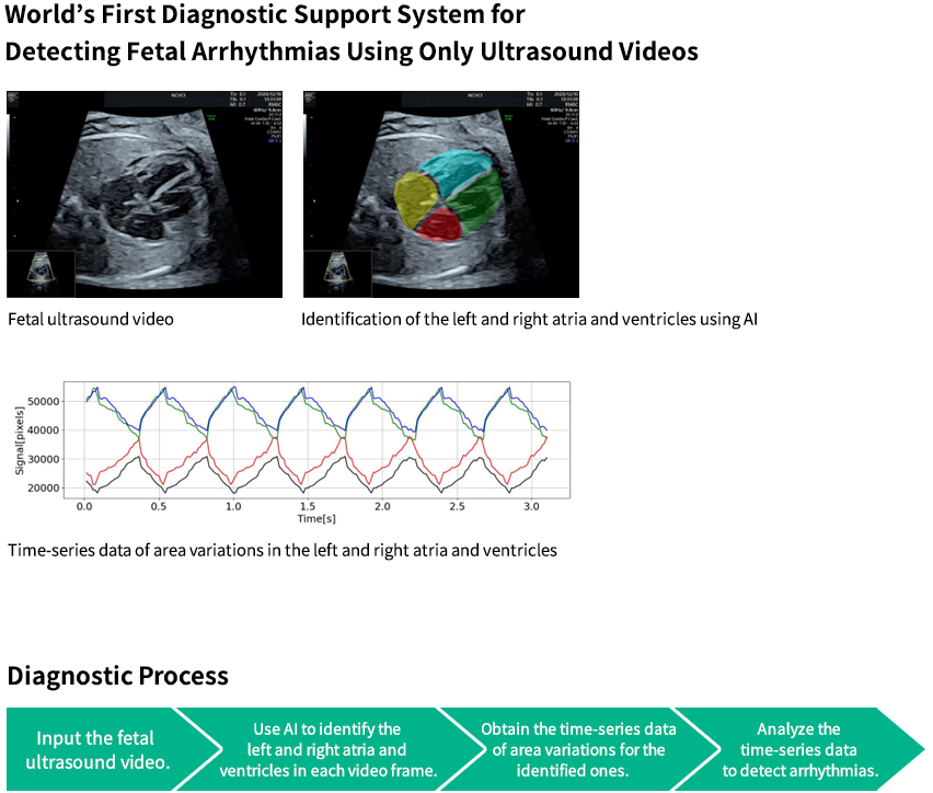 AI-Based Diagnostic Support System for Fetal Arrhythmia Using Ultrasound Videos